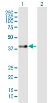 Anti-ACAT2 antibody produced in mouse