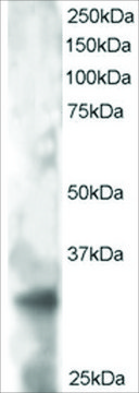 Anti-PHEMX/TSPAN32 antibody produced in goat
