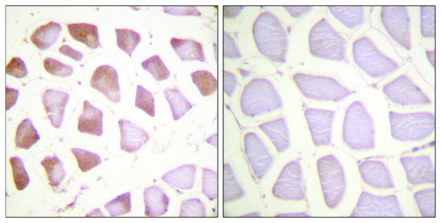 Anti-TNNI3 antibody produced in rabbit