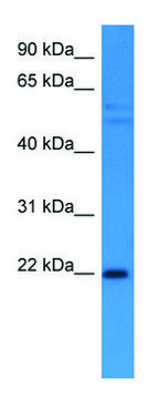 Anti-GADD45A (C-terminal) antibody produced in