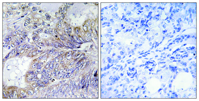 Anti-BAD antibody produced in rabbit