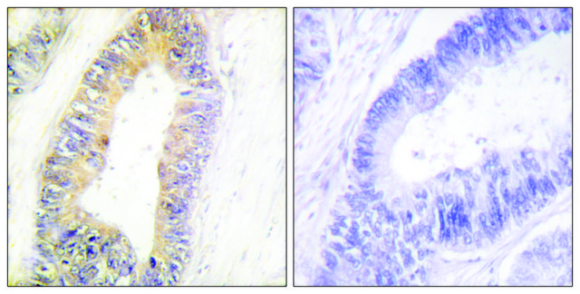 Anti-ZNF638 antibody produced in rabbit