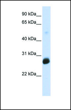 Anti-RNF186 antibody produced in rabbit