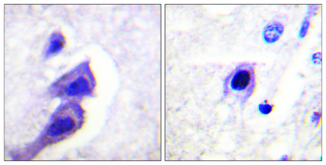 Anti-TSC2, C-Terminal antibody produced in