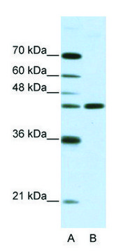 Anti-NMUR2 (N-terminal) antibody produced in