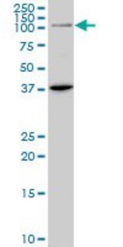 ANTI-PRDM1 antibody produced in mouse