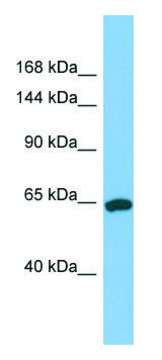 Anti-TPO (N-terminal) antibody produced in