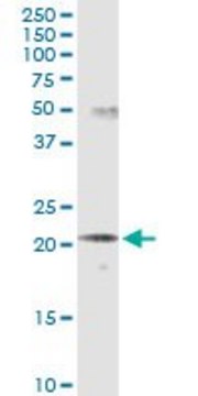 Monoclonal Anti-SCNM1 antibody produced in