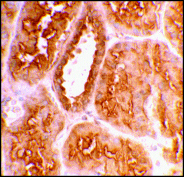Anti-ACE2 antibody produced in rabbit