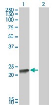 ANTI-RCV1 antibody produced in mouse