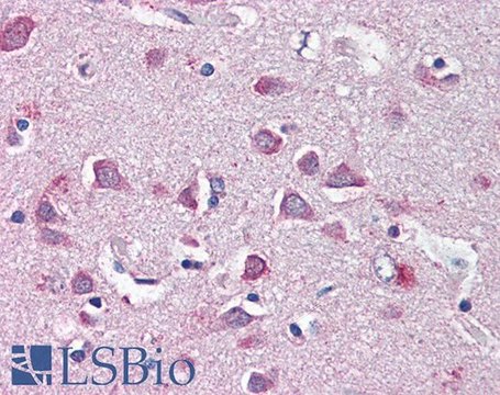 Anti-nf2b antibody produced in goat