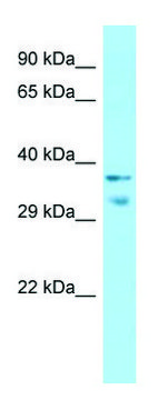 Anti-MRGPRX1 (C-terminal) antibody produced in