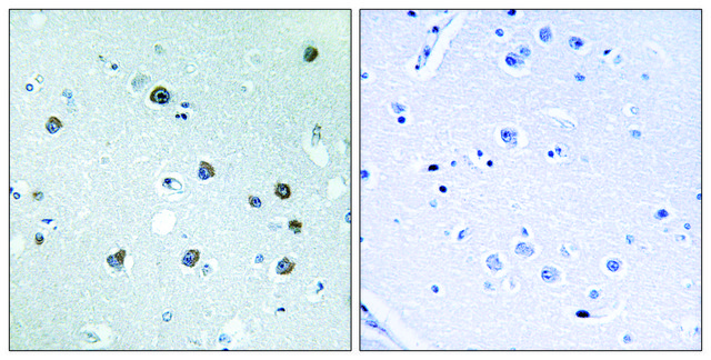 Anti-MYO1D antibody produced in rabbit