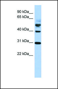 Anti-TTL antibody produced in rabbit