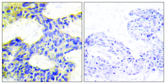 Anti-S6K antibody produced in rabbit