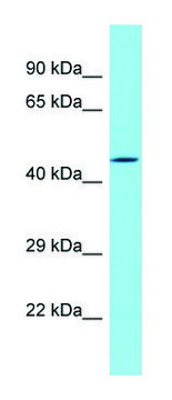 Anti-DBF4B (N-terminal) antibody produced in