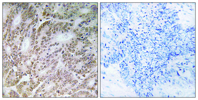 Anti-UBQLN4 antibody produced in rabbit