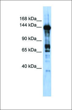 Anti-CASZ1 antibody produced in rabbit