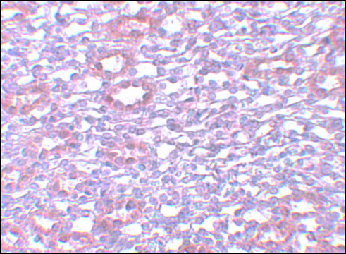 Anti-PIAS1 antibody produced in rabbit