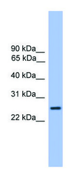 Anti-GOSR1 (C-terminal) antibody produced in