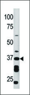 Anti-ART1 (N-term) antibody produced in