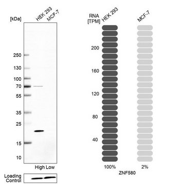 Anti-ZNF580 antibody produced in rabbit