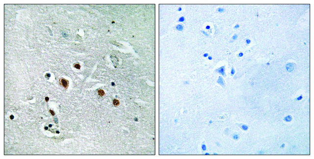 Anti-MED13L antibody produced in rabbit