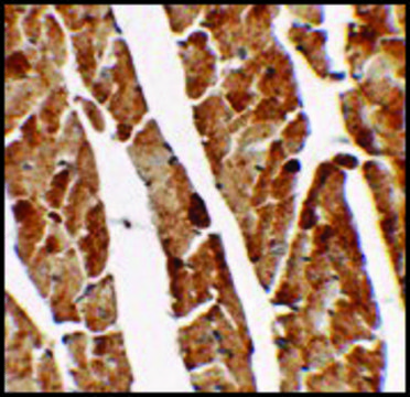 Anti-TGM5 antibody produced in rabbit