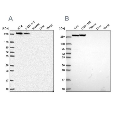 Anti-CAD antibody produced in rabbit