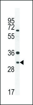 ANTI-ARV1 (N-TERMINAL) antibody produced in