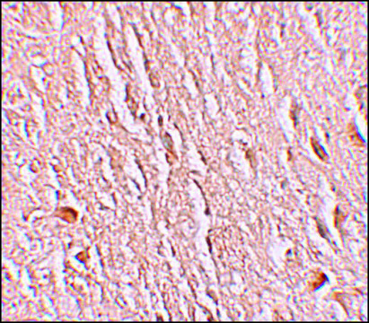 Anti-LRRTM3 antibody produced in rabbit