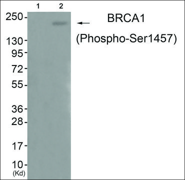 Anti-phospho-BRCA1 (pSer¹???) antibody produced in