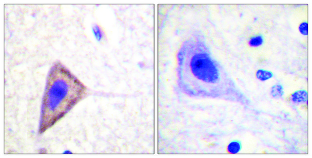 Anti-KV1.3 antibody produced in rabbit