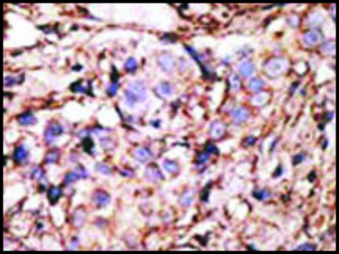 Anti-NR6A1 (C-term) antibody produced in