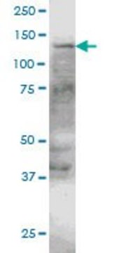 ANTI-ERN1 antibody produced in mouse