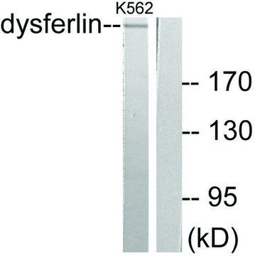 Anti-Dysferlin, antibody produced in rabbit