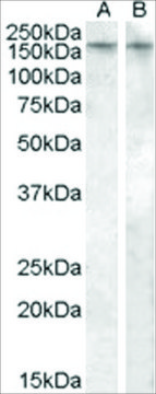 Anti-AVPR1B (AB1) antibody produced in
