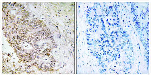 Anti-ZNF592 antibody produced in rabbit
