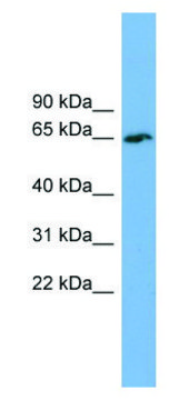 Anti-TBC1D24 antibody produced in rabbit