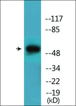 Anti-phospho-Mnk1 (pThr³??) antibody produced in