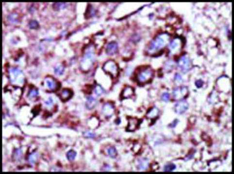 Anti-DGKZ (C-term) antibody produced in