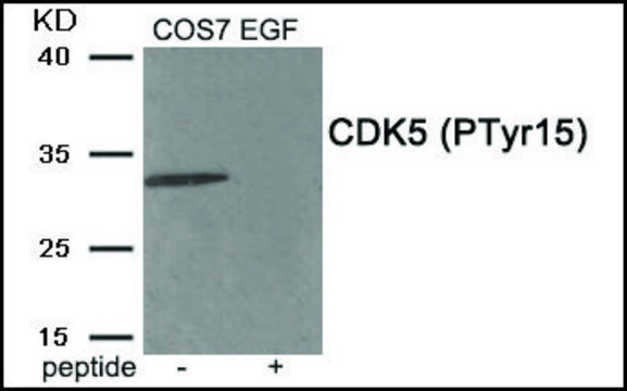 Anti-phospho-CDK5 (pTyr¹?) antibody produced in