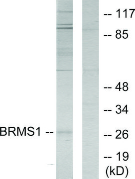 Anti-BRMS1 antibody produced in rabbit