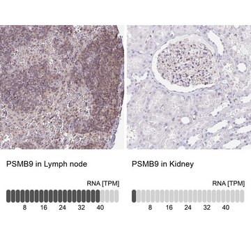 Anti-PSMB9 antibody produced in rabbit