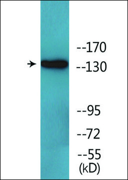 Anti-phospho-EGFR (pTyr¹¹¹?) antibody produced in