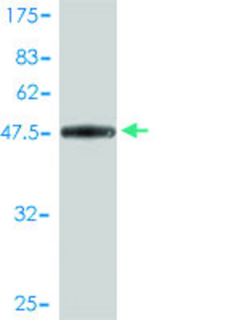 Monoclonal Anti-DSU antibody produced in