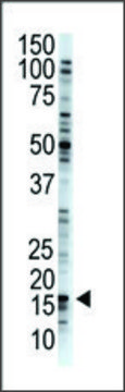 Anti-USP29 (N-term) antibody produced in