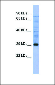 Anti-PSMA5 antibody produced in rabbit