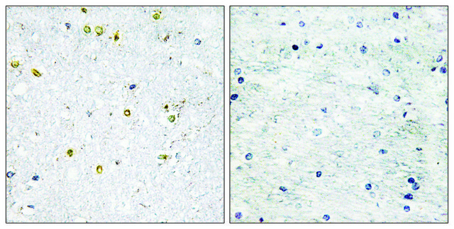 Anti-TRIM24 antibody produced in rabbit