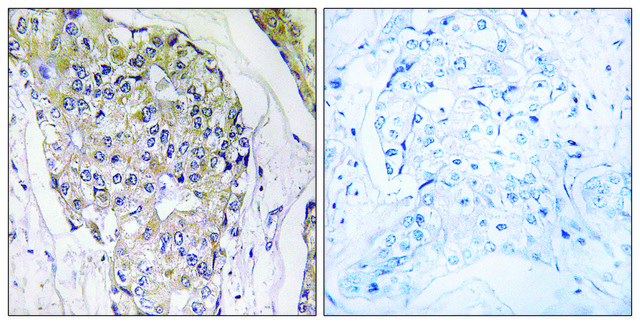 Anti-NDUFS6 antibody produced in rabbit